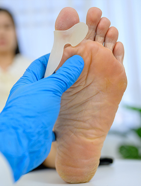 traitement hallux valgus